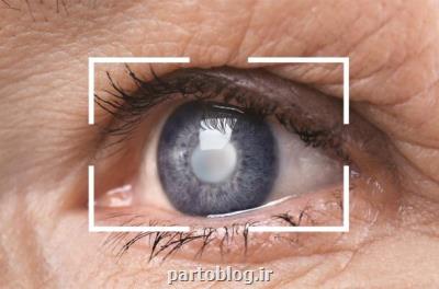 استفاده از یك آنتی اكسیدان طبیعی تأثیر مثبتی در شبكیه چشم دارد