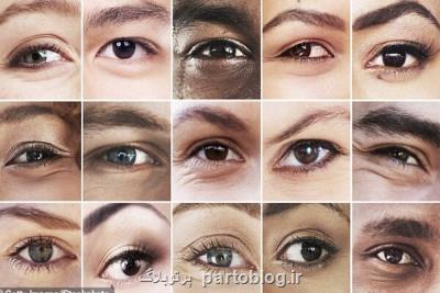 شناسایی 50 ژن كه در تعیین رنگ چشم دخالت دارند